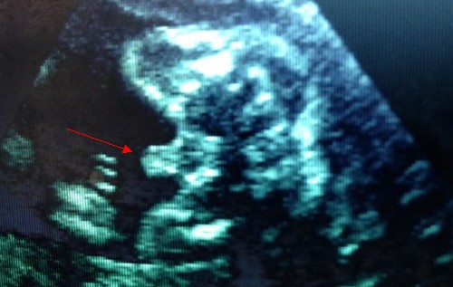 1449632731843378.jpg 1.jpg