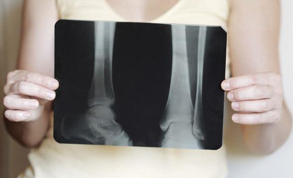 1450836032335181.jpg snap069.jpg