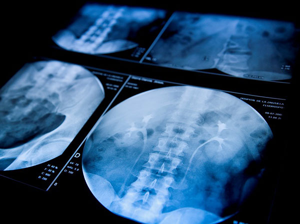 1451958828838552.jpg l60-1070597.jpg