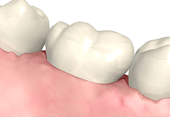 晚上睡覺(jué)磨牙是什么原因 應(yīng)該怎么治療 晚上睡覺(jué)磨牙是什么原因 應(yīng)該怎么治療