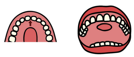 牙齒不整齊怎么辦 3招就可矯正 牙齒不整齊怎么辦 3招就可矯正