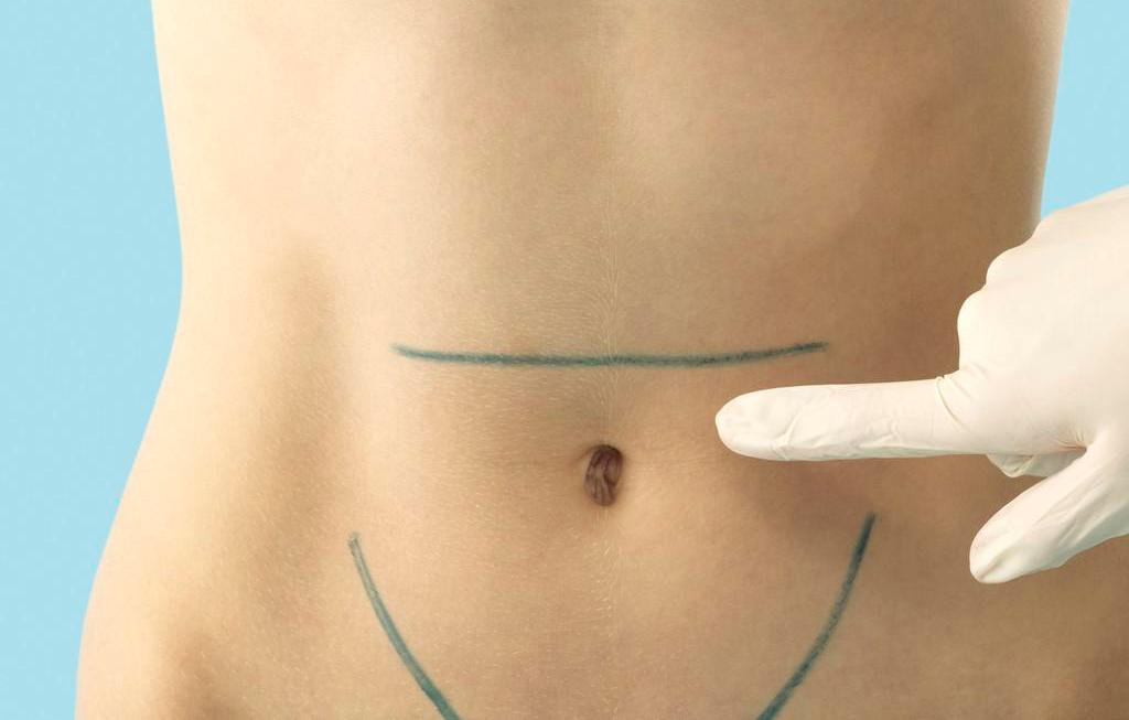 腹部肥胖該如何減肥 腹部肥胖該如何減肥