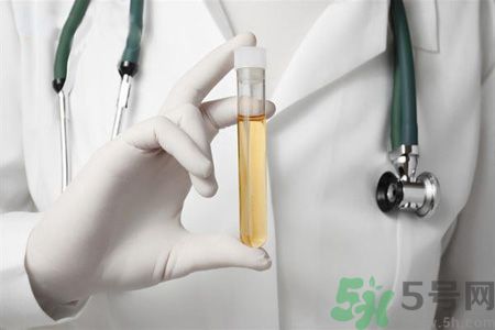 尿蛋白是什么?尿蛋白怎么改善好? 尿蛋白是什么?尿蛋白怎么改善好?