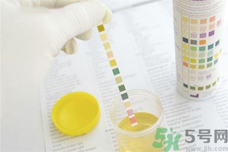 尿蛋白是什么?尿蛋白怎么改善好? 尿蛋白是什么?尿蛋白怎么改善好?