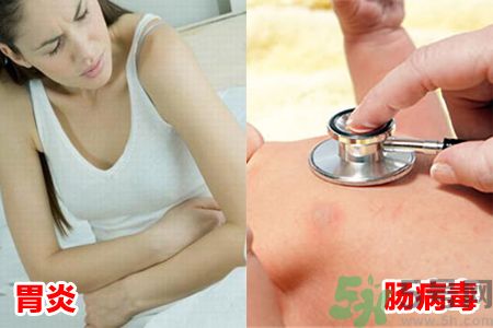 胃炎和腸病毒難分辨?胃炎和腸病毒有什么不同 胃炎和腸病毒難分辨?胃炎和腸病毒有什么不同