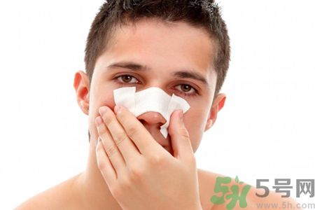 鼻子出血怎么回事?鼻子出血如何快速止血? 鼻子出血怎么回事?鼻子出血如何快速止血?