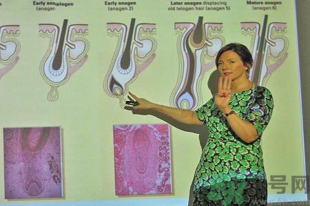 女性掉頭發(fā)很厲害是什么原因？掉頭發(fā)怎么辦？