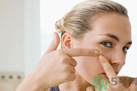 牙膏可以祛痘嗎？牙膏可以祛黑頭嗎？