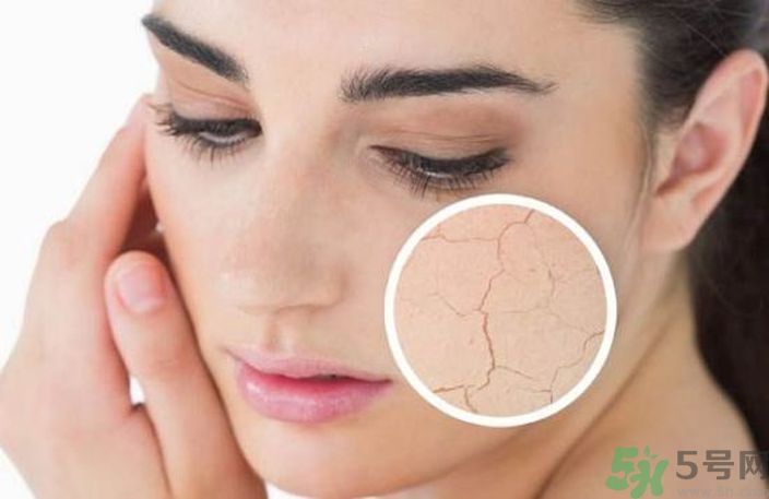 皮膚起皮怎么辦？皮膚起皮用什么護(hù)膚品？