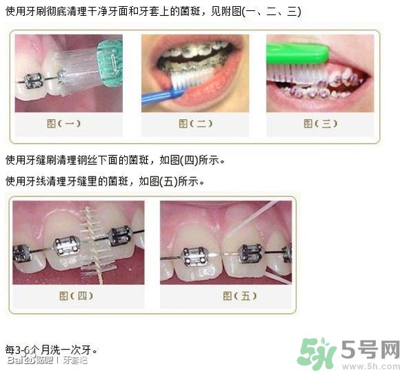 18歲還能戴牙套嗎？戴牙套真的能瘦臉改變臉型嗎？