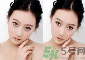 我的黑眼圈為什么是咖啡色的？怎么去除咖啡色黑眼圈？