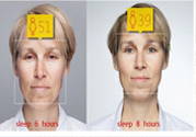失眠會變丑嗎？失眠的人易變丑是真的嗎？
