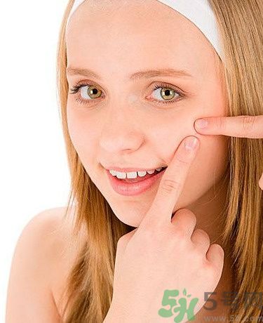 臉上有痘印怎么去除？去除痘印的小妙方？