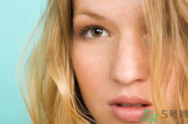 臉上有斑怎么去除？祛斑的小偏方有哪些？