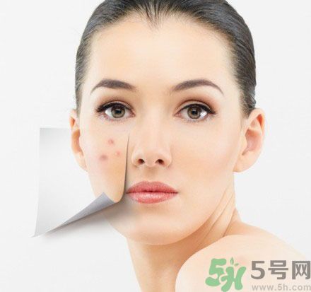 臉上有斑怎么去除？祛斑的小偏方有哪些？