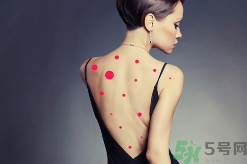 背上為什么會長痘痘？長痘痘怎么辦？