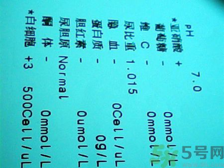 懷孕尿液檢查結(jié)果分析怎么看?孕婦為什么要做尿檢?.jpg 懷孕尿液檢查結(jié)果分析怎么看?孕婦為什么要做尿檢?.jpg