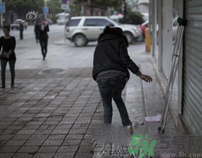 學(xué)生患東方美女病是怎么回事？東方美女病是什么??？