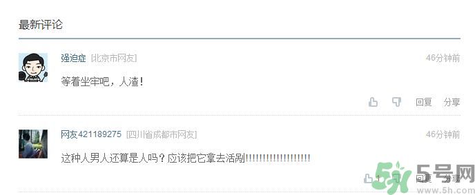 男將妻子雙手按入油鍋致二級(jí)燒傷 二級(jí)燒傷嚴(yán)重嗎?怎么處理 男將妻子雙手按入油鍋致二級(jí)燒傷 二級(jí)燒傷嚴(yán)重嗎?怎么處理