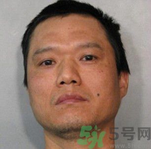 男將妻子雙手按入油鍋致二級(jí)燒傷 二級(jí)燒傷嚴(yán)重嗎?怎么處理 男將妻子雙手按入油鍋致二級(jí)燒傷 二級(jí)燒傷嚴(yán)重嗎?怎么處理