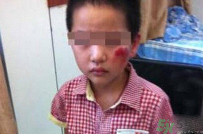 男孩遭校長暴打的結(jié)果是什么？男孩遭校長暴打的真相是什么？