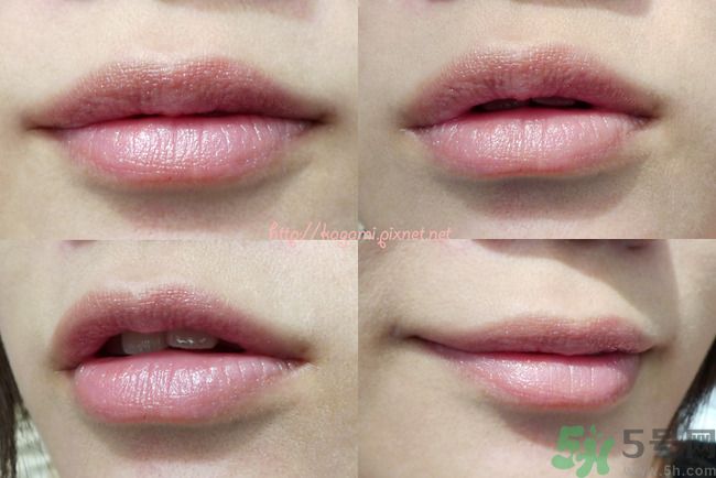 唇色發(fā)白是怎么回事？唇色發(fā)白怎么辦？