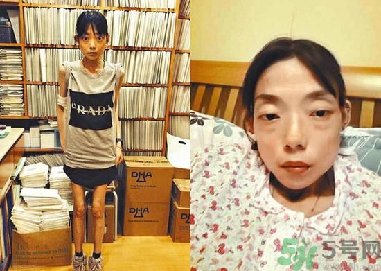 富二代離婚娶二線女星前妻瘦成骷髏  怎么選擇有責(zé)任的男人？