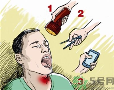 魚刺卡喉喝醋可以治療嗎？魚刺卡喉喝醋好不好？