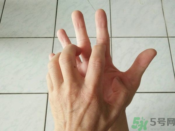 手上起水泡是什么原因？怎樣預(yù)防手上起水泡？