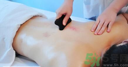 夏季刮痧好嗎？刮痧能治療什么疾??？