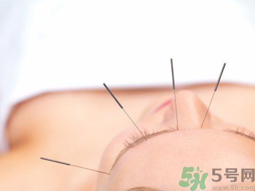 1461985716597507.jpg 針灸.jpg