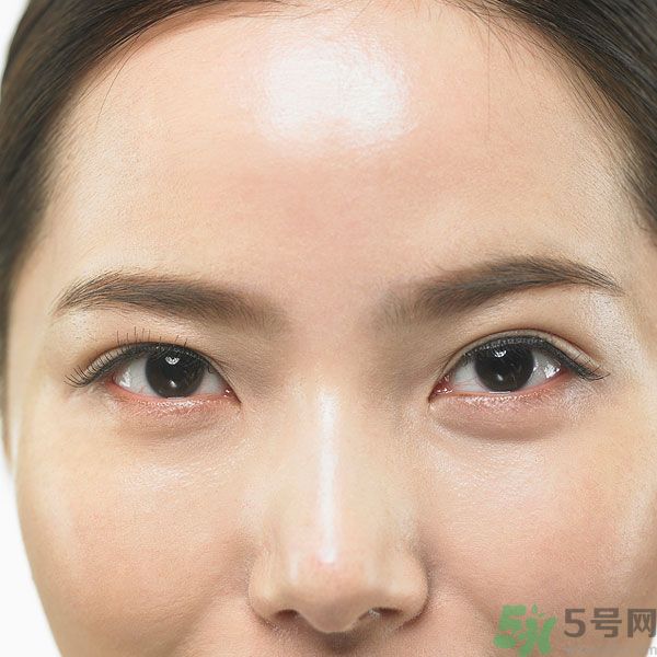 眉周紋是怎么形成的？眉周紋怎么去除？
