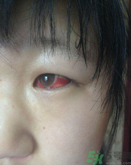 初中生全體甲醛中毒是怎么回事？初中生全體甲醛中毒是哪個(gè)學(xué)校？