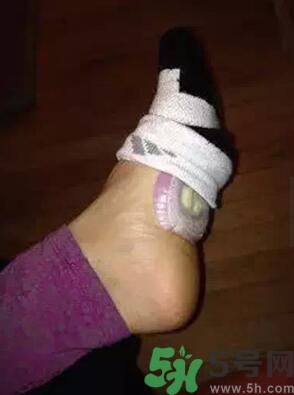 發(fā)燒可以吃洋蔥嗎？發(fā)燒能吃洋蔥嗎？