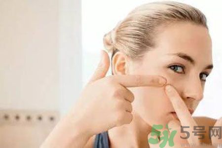 一到夏天呢長(zhǎng)痘痘怎么回事？夏天長(zhǎng)痘痘怎么辦？