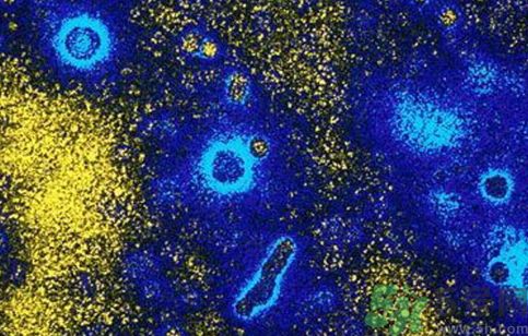 美國超級細(xì)菌現(xiàn)身 超級細(xì)菌能抵抗所有抗生素嗎? 美國超級細(xì)菌現(xiàn)身 超級細(xì)菌能抵抗所有抗生素嗎?