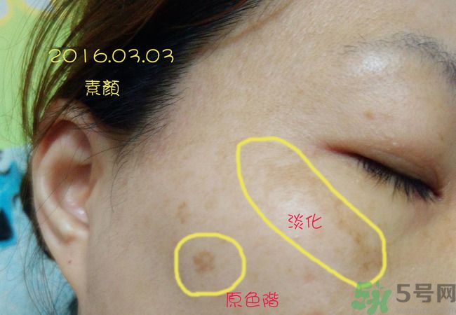 sk2祛斑精華怎么樣？skii祛斑精華使用方法