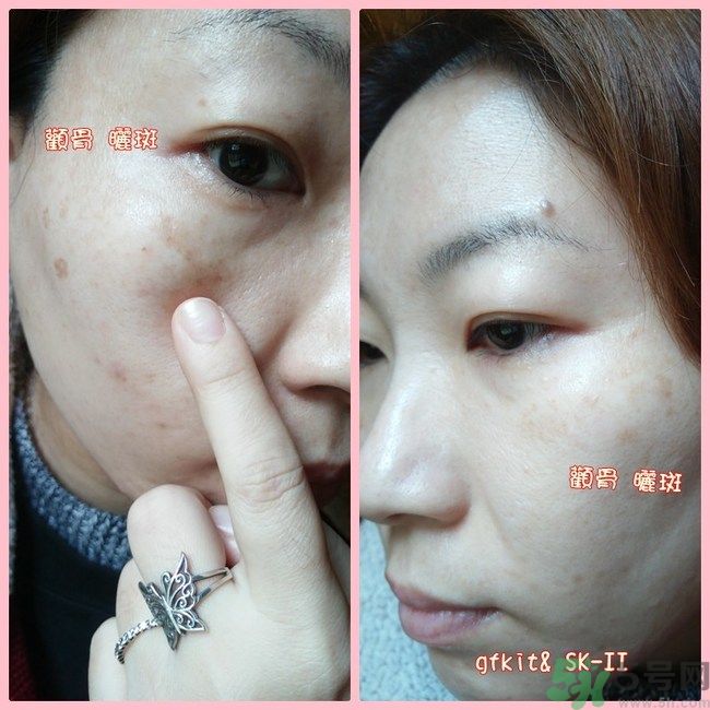 sk2祛斑精華怎么樣？skii祛斑精華使用方法