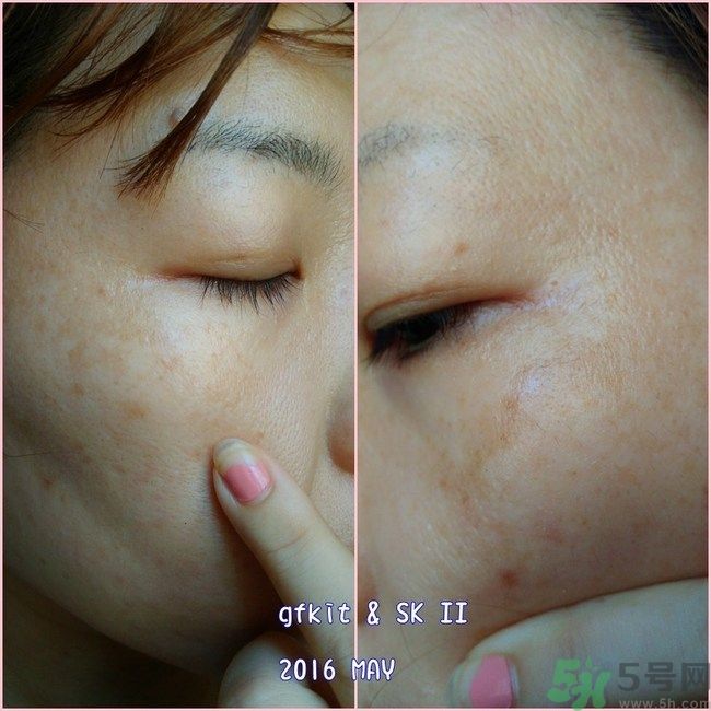 sk2祛斑精華怎么樣？skii祛斑精華使用方法
