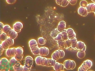 葡萄胎清宮后hcg多久能恢復正常?葡萄胎清宮后注意事項 葡萄胎清宮后hcg多久能恢復正常?葡萄胎清宮后注意事項