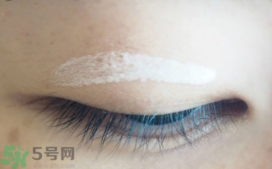 單眼皮怎么變雙眼皮了？單眼皮上面有一條線