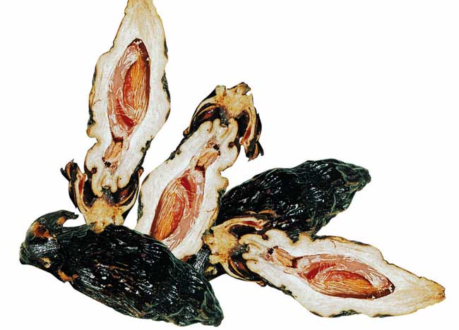 嚼檳榔的好處和壞處 嚼檳榔頭暈怎么回事？