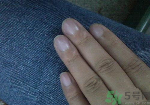 指甲發(fā)紫是什么原因？指甲發(fā)紫是怎么回事？