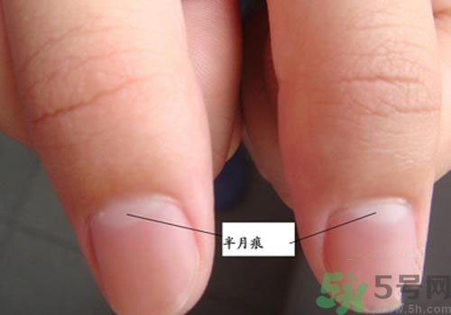 指甲沒(méi)有月牙是什么原因？指甲沒(méi)有月牙怎么調(diào)理？