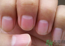指甲沒有月牙是什么原因？指甲沒有月牙怎么調理？