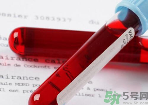 獻(xiàn)血后可以洗澡嗎？抽血后可以洗澡嗎？