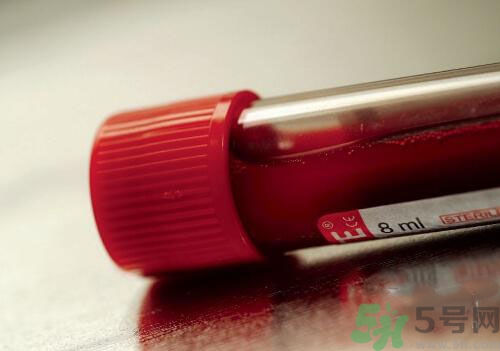 獻(xiàn)血后可以洗澡嗎？抽血后可以洗澡嗎？