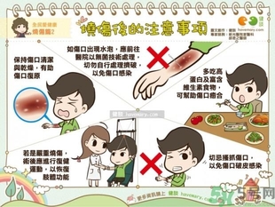 手被油燙傷了怎么處理？手被油燙起泡了怎么辦？