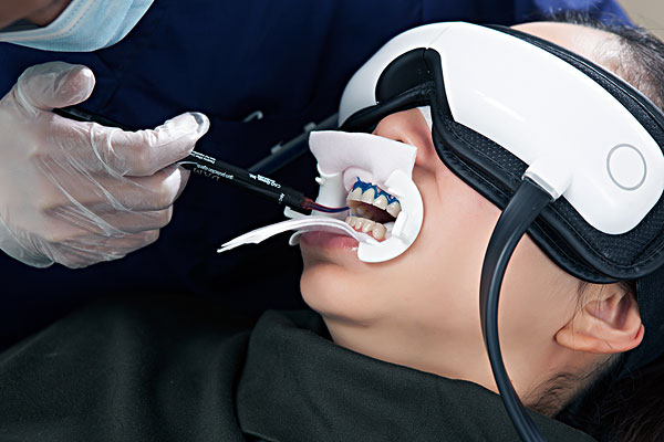 嚴重口腔潰瘍怎么快速好的快？嚴重口腔潰瘍能抽煙嗎？