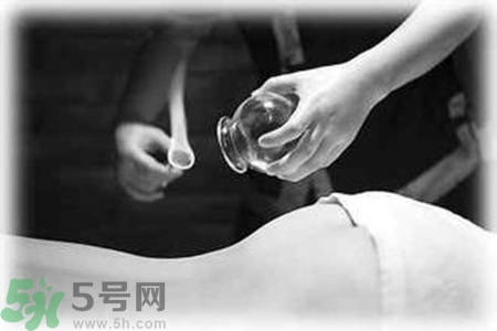 大暑可以拔罐嗎？大暑拔罐好不好？